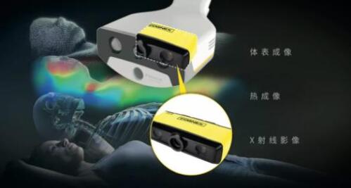 康耐视3D-A5060三维面阵视觉系统助力精准放疗，实现人体定位监控新维度(图1)